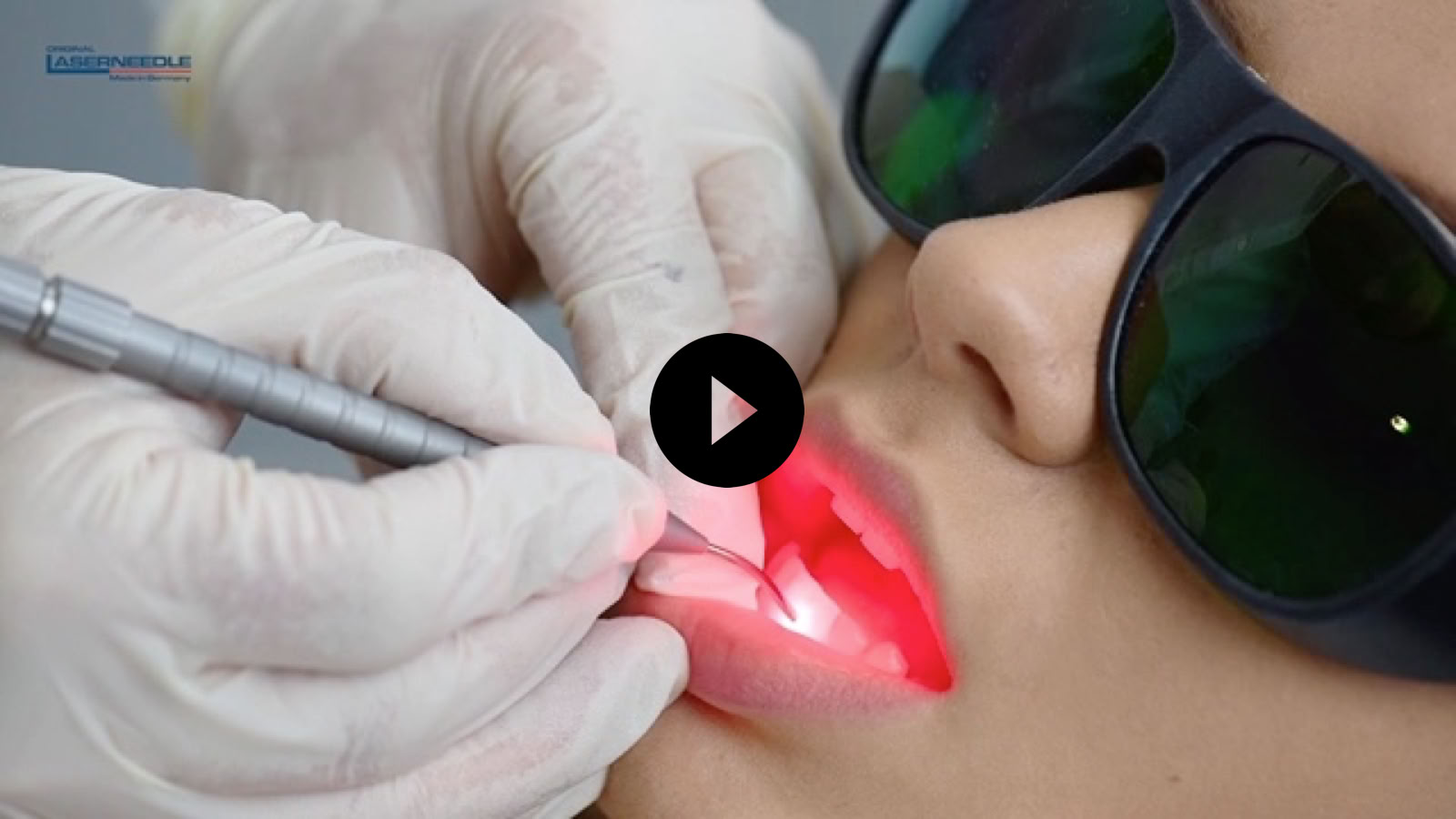 Video Video abspielen